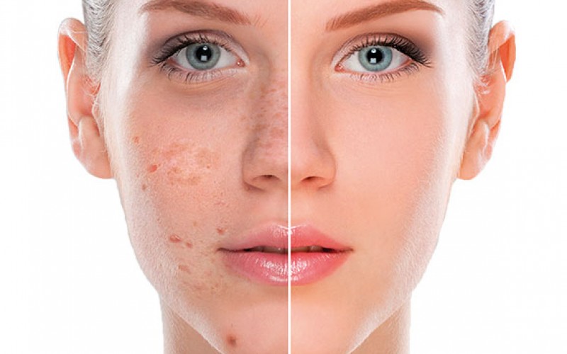 Effectieve online oplossingen voor huidproblemen