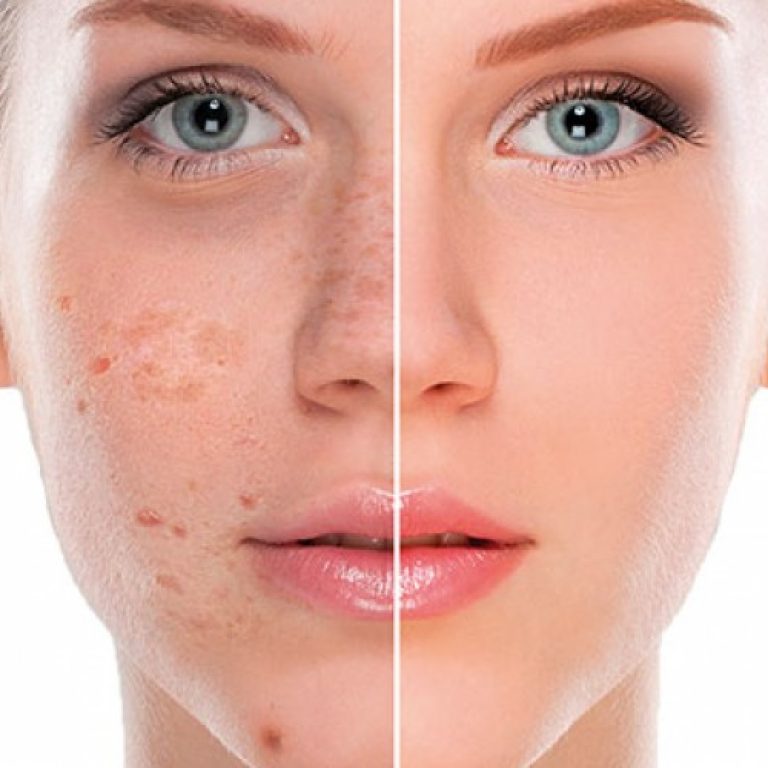 Effectieve online oplossingen voor huidproblemen